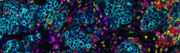 PerkinElmer: Tissue Biomarker Analysis: A Practical Approach for Translational Research
